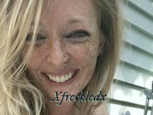 Xfreckledx